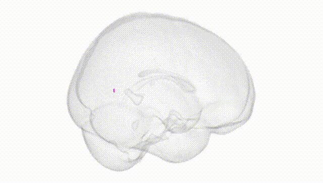 Full Brain White