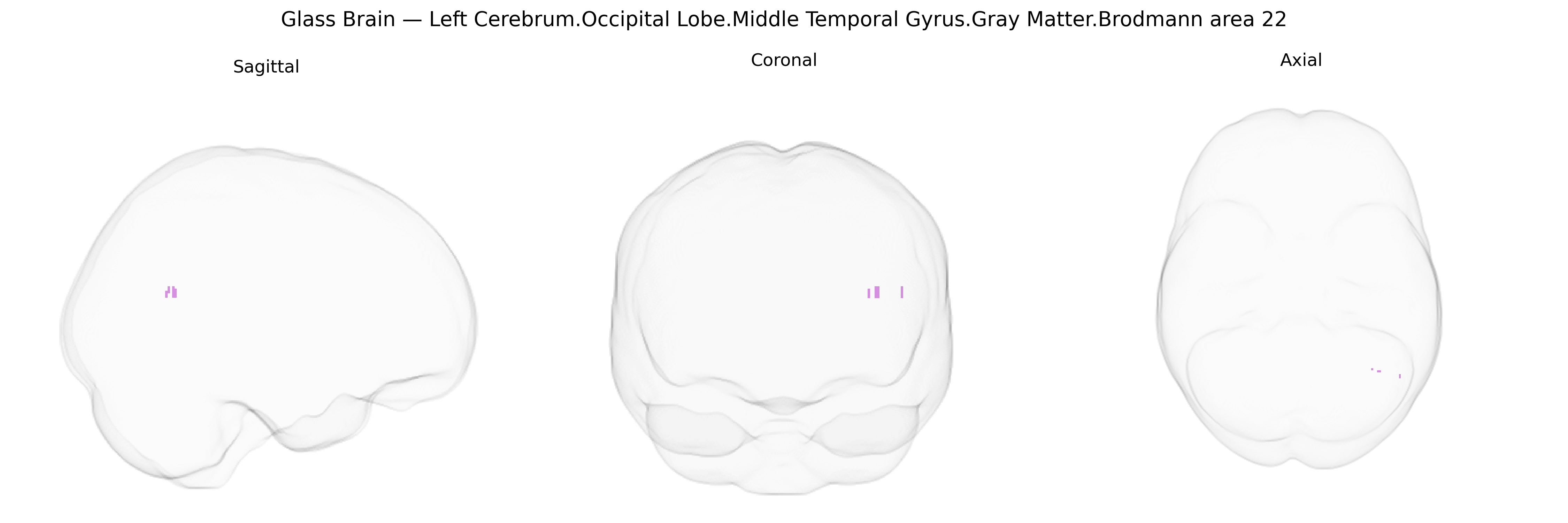 Triplanar Ghost Brain