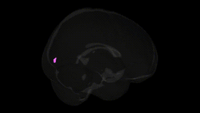 Full Brain Black
