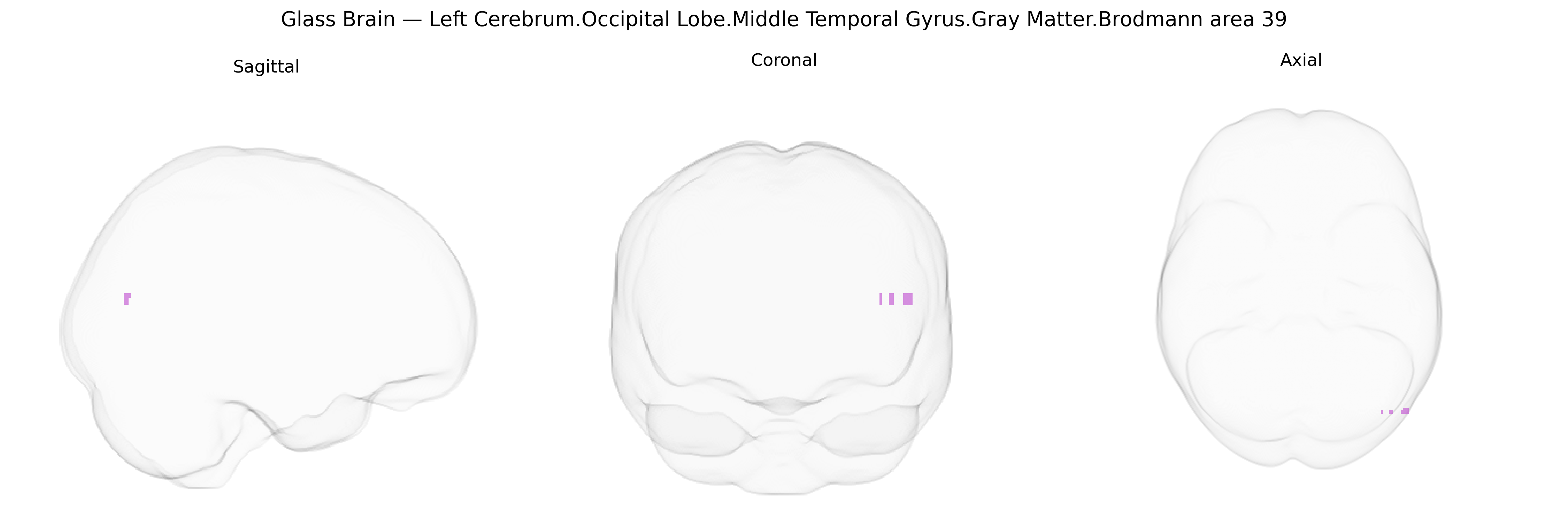 Triplanar Ghost Brain