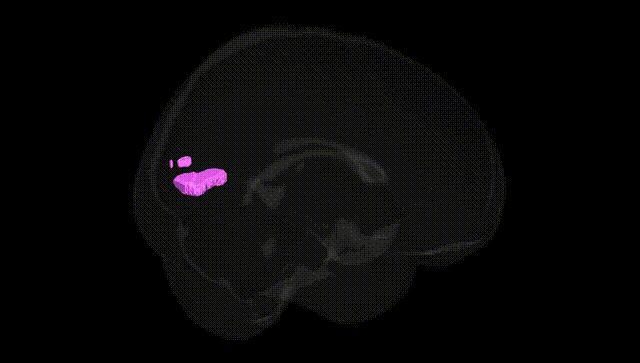Full Brain Black