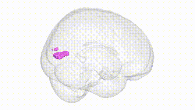 Full Brain White