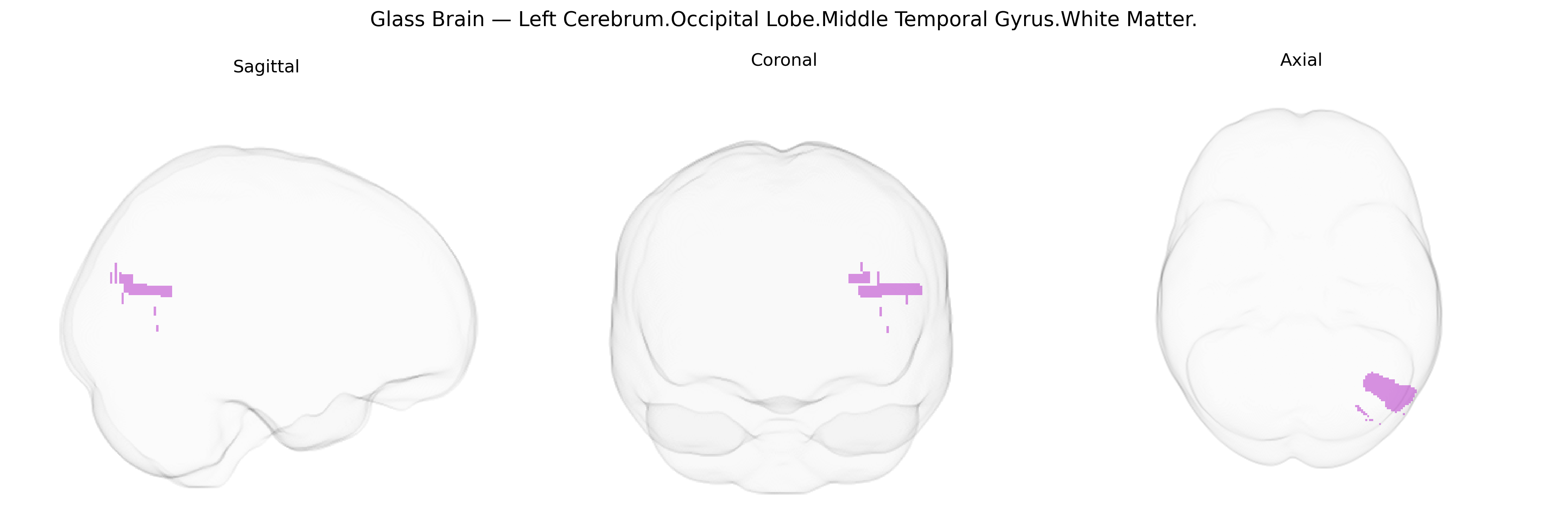 Triplanar Ghost Brain