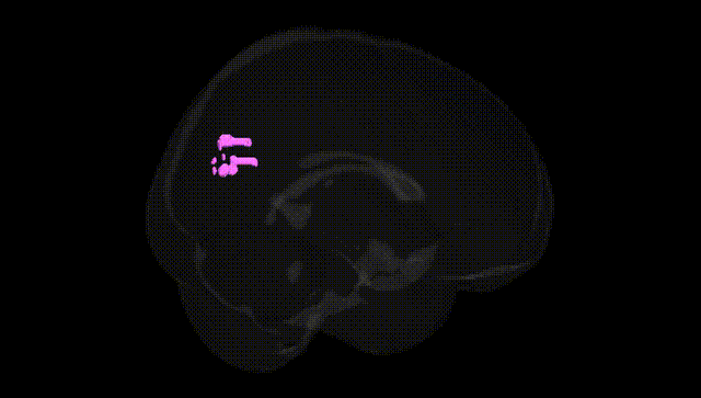 Full Brain Black