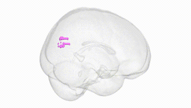 Full Brain White