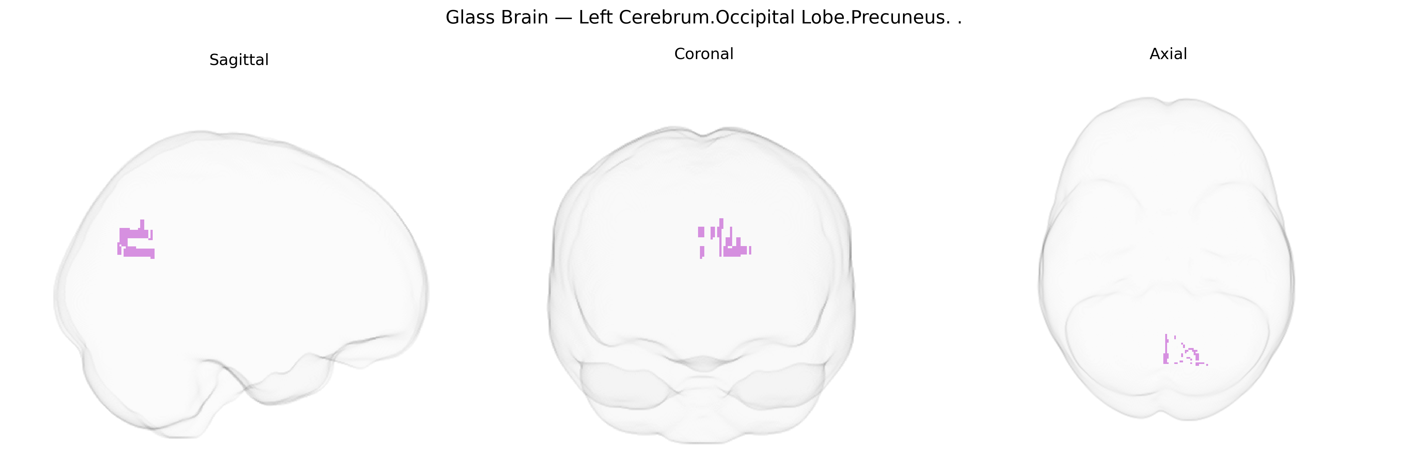 Triplanar Ghost Brain