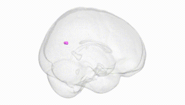 Full Brain White