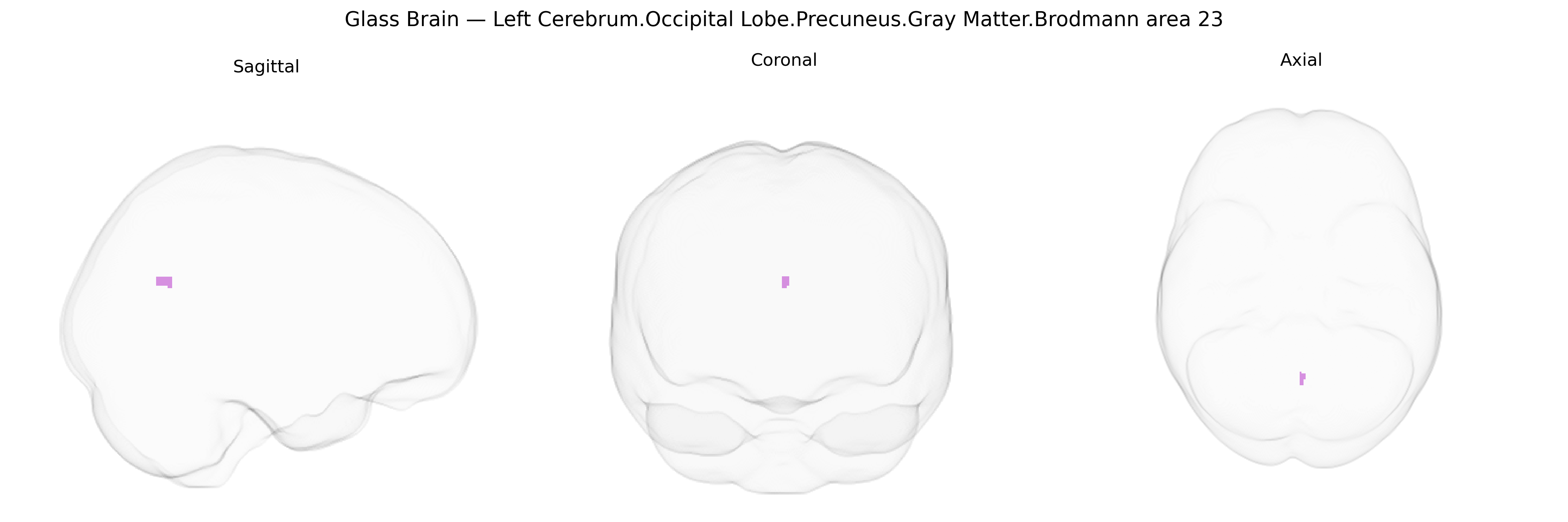 Triplanar Ghost Brain