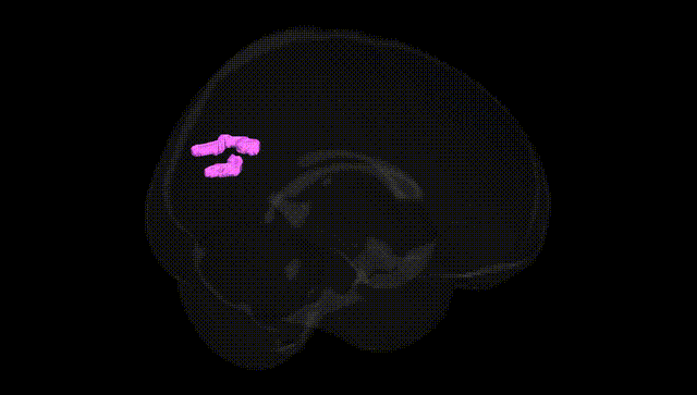 Full Brain Black