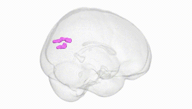 Full Brain White