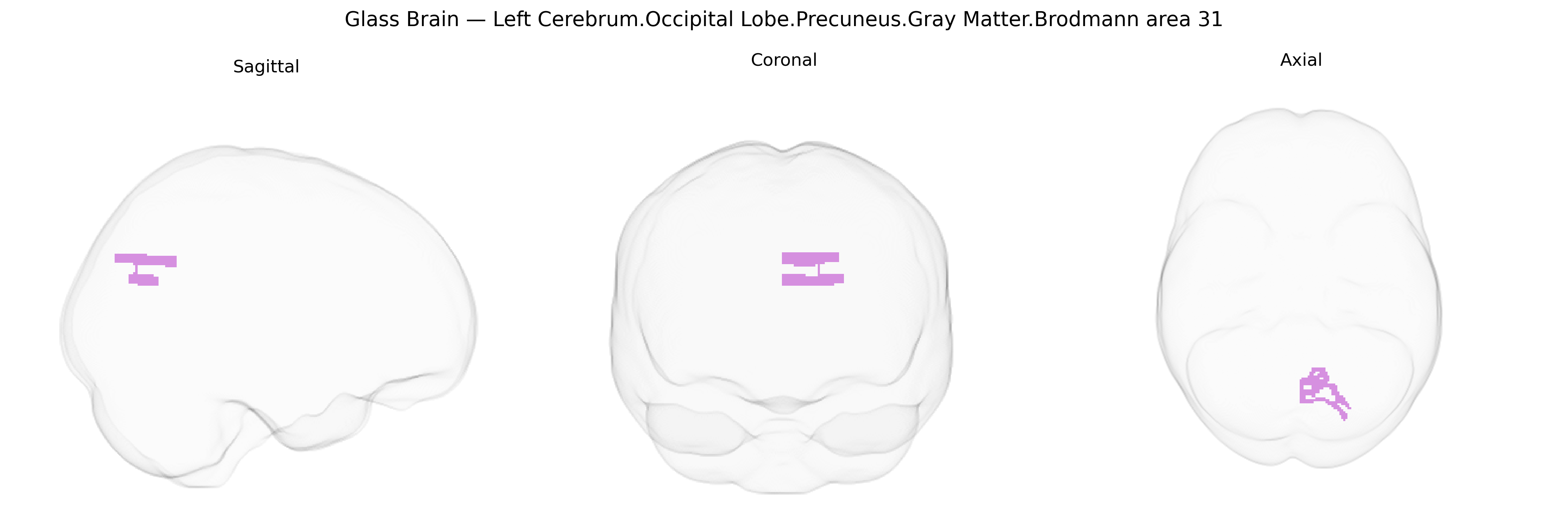 Triplanar Ghost Brain