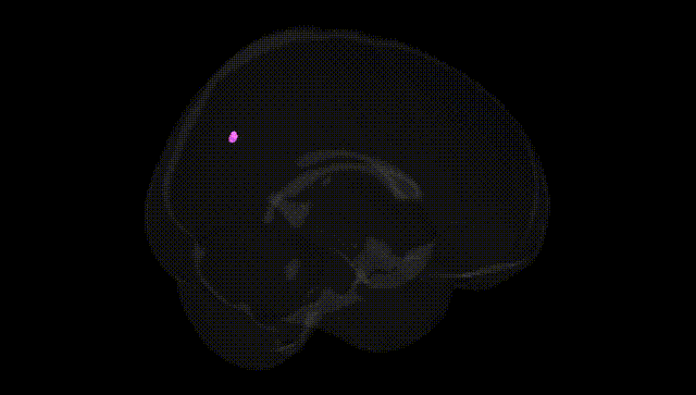 Full Brain Black
