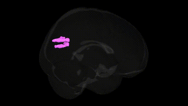Full Brain Black