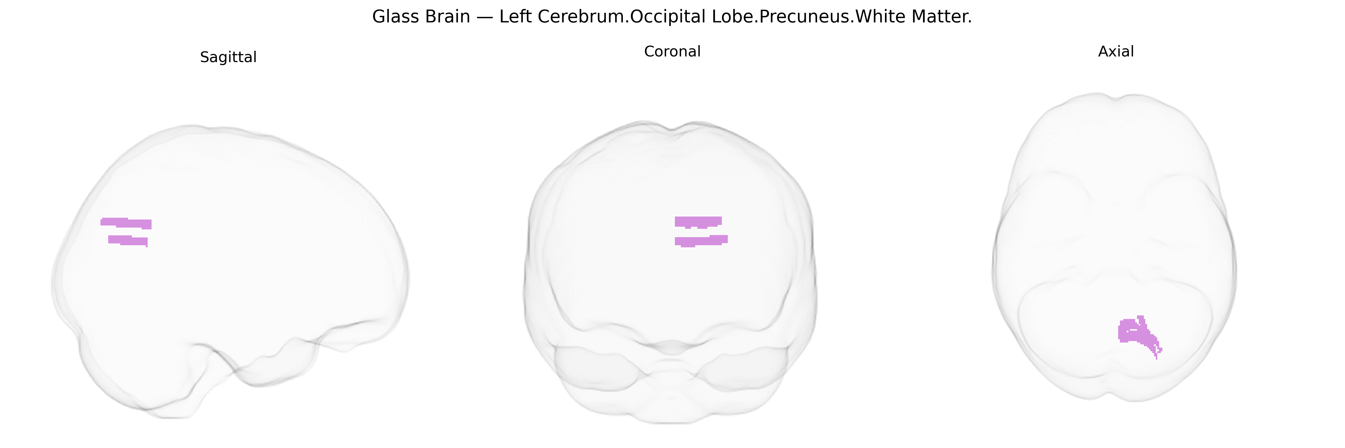 Triplanar Ghost Brain
