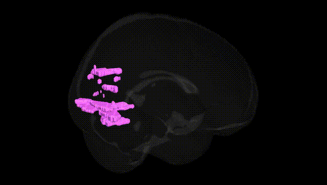Full Brain Black