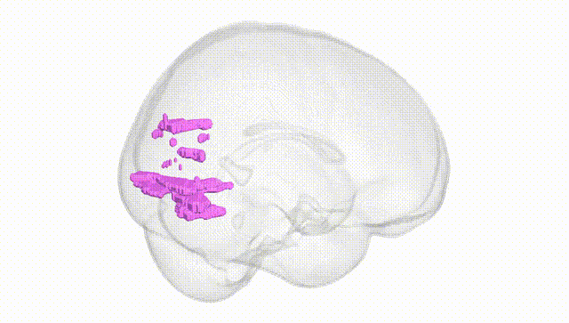 Full Brain White