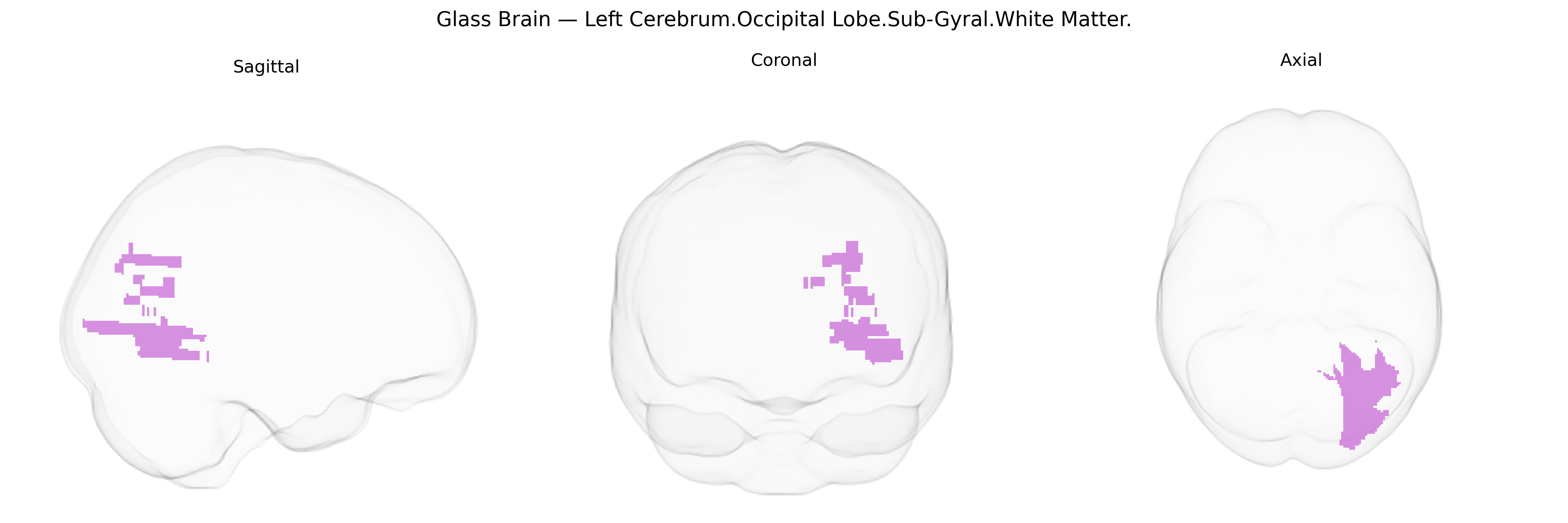 Triplanar Ghost Brain