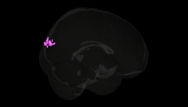 Full Brain Black