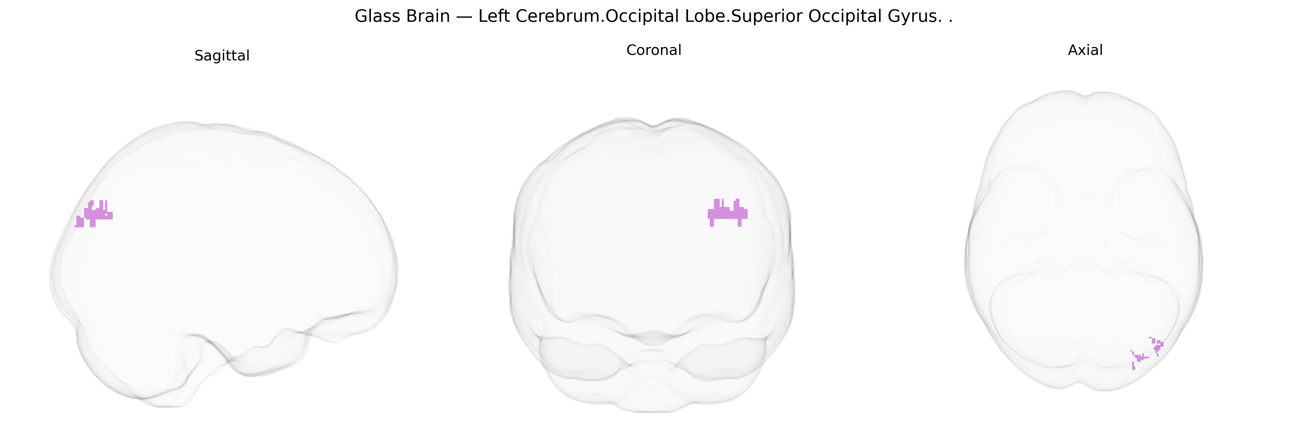 Triplanar Ghost Brain