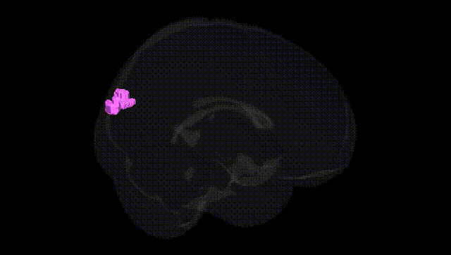 Full Brain Black