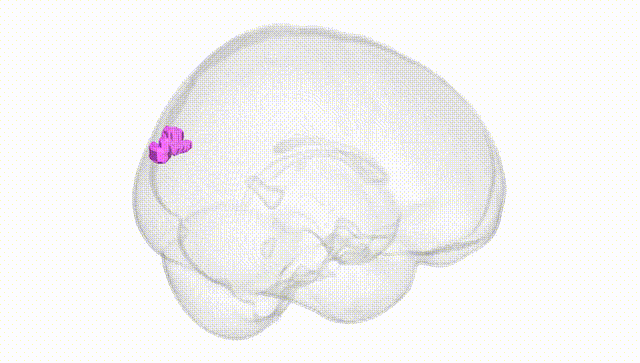 Full Brain White
