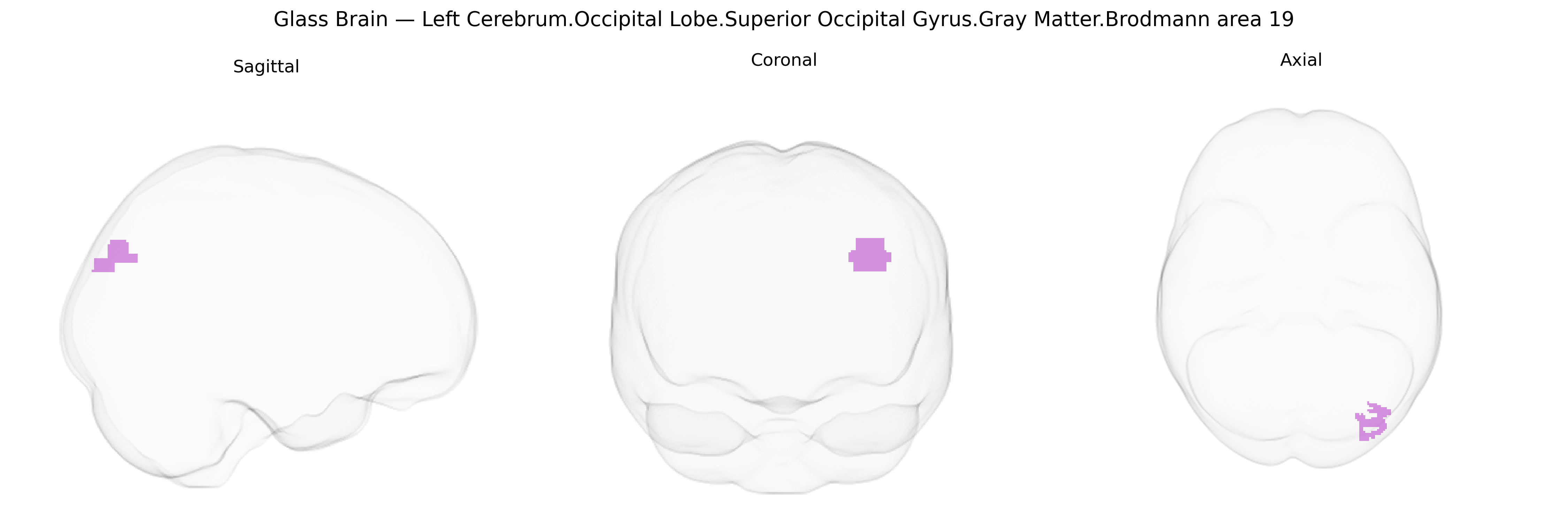 Triplanar Ghost Brain