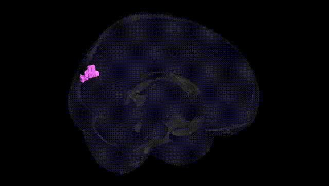 Full Brain Black