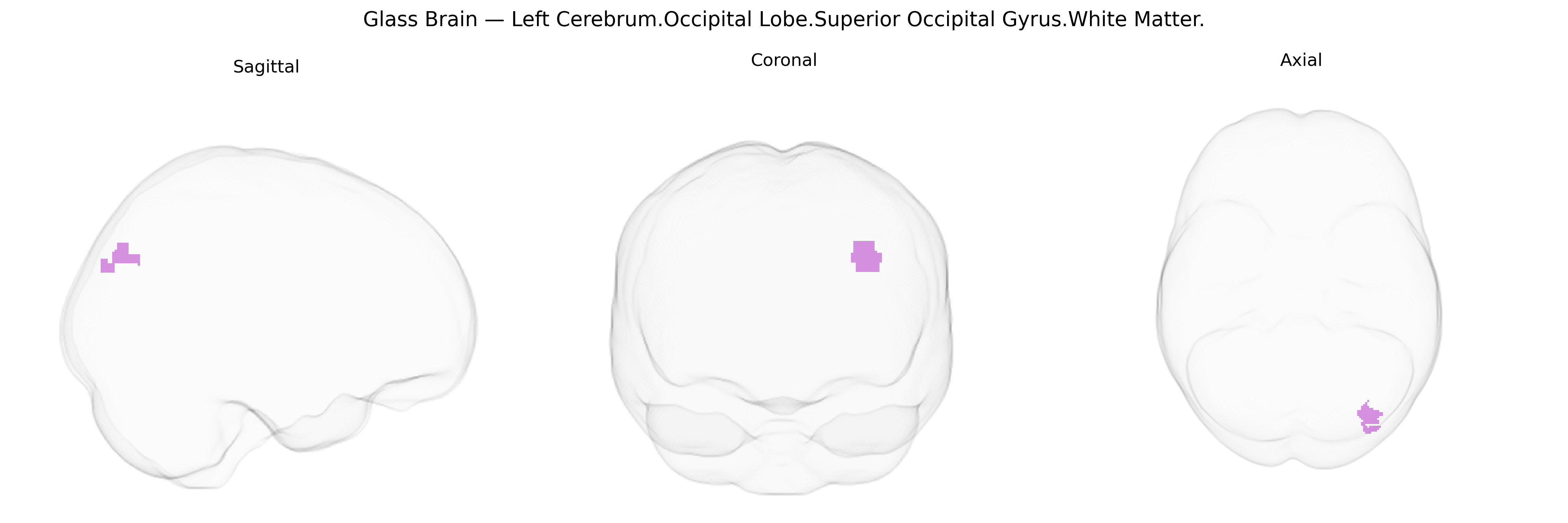 Triplanar Ghost Brain