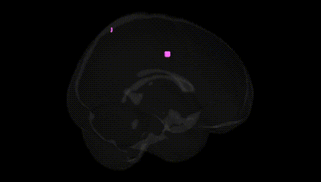 Full Brain Black