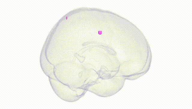 Full Brain White