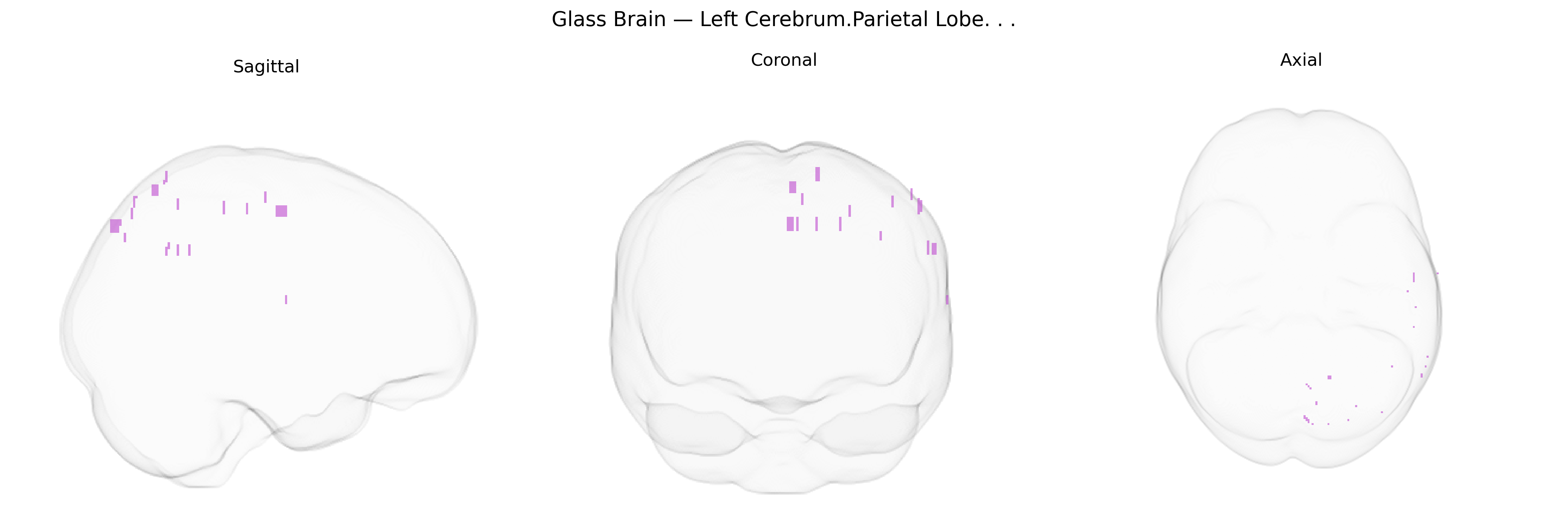 Triplanar Ghost Brain