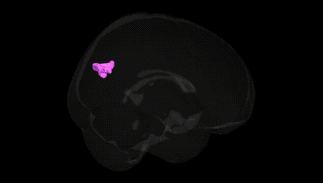 Full Brain Black