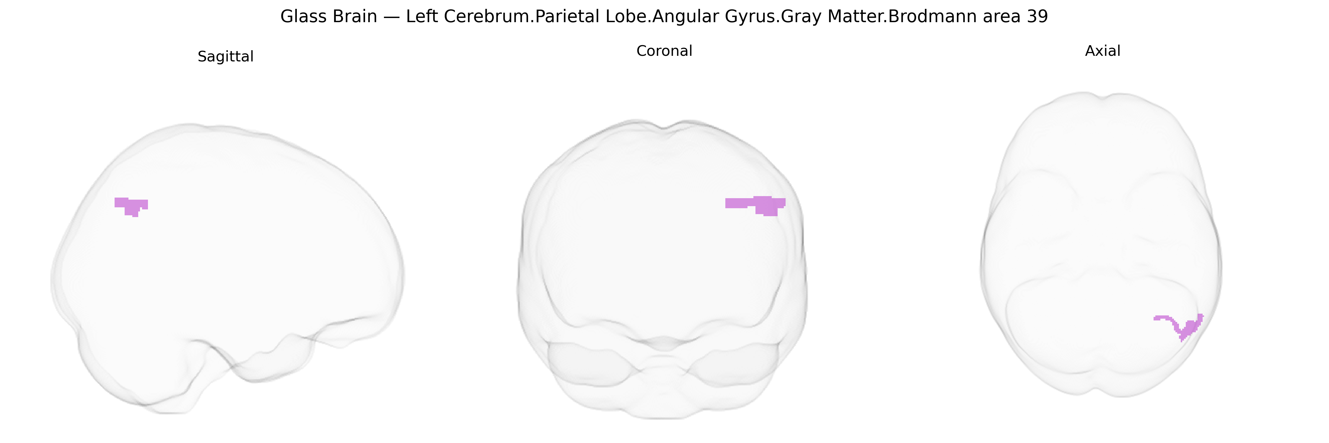 Triplanar Ghost Brain