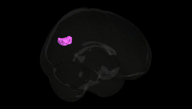 Full Brain Black