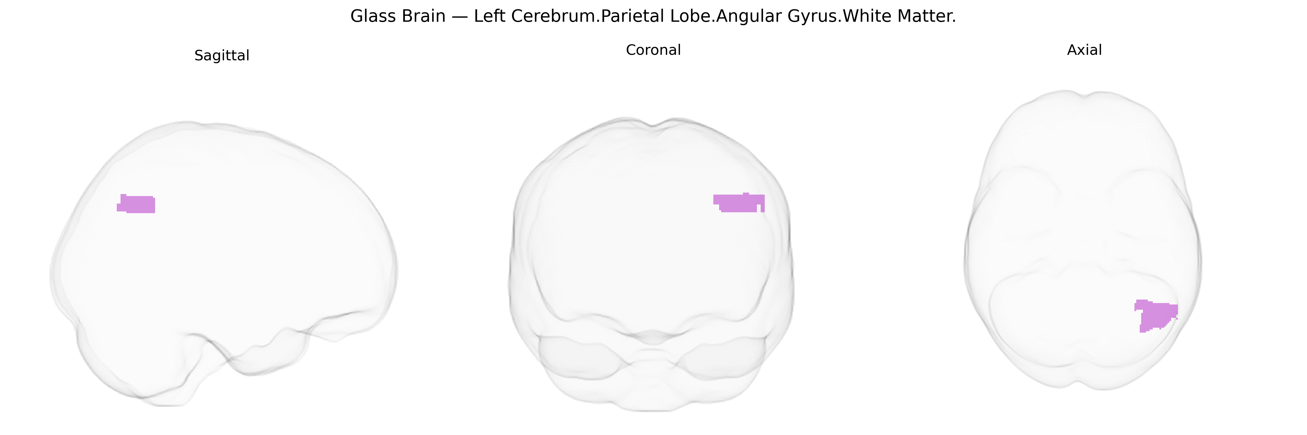 Triplanar Ghost Brain