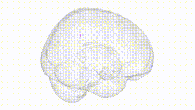Full Brain White