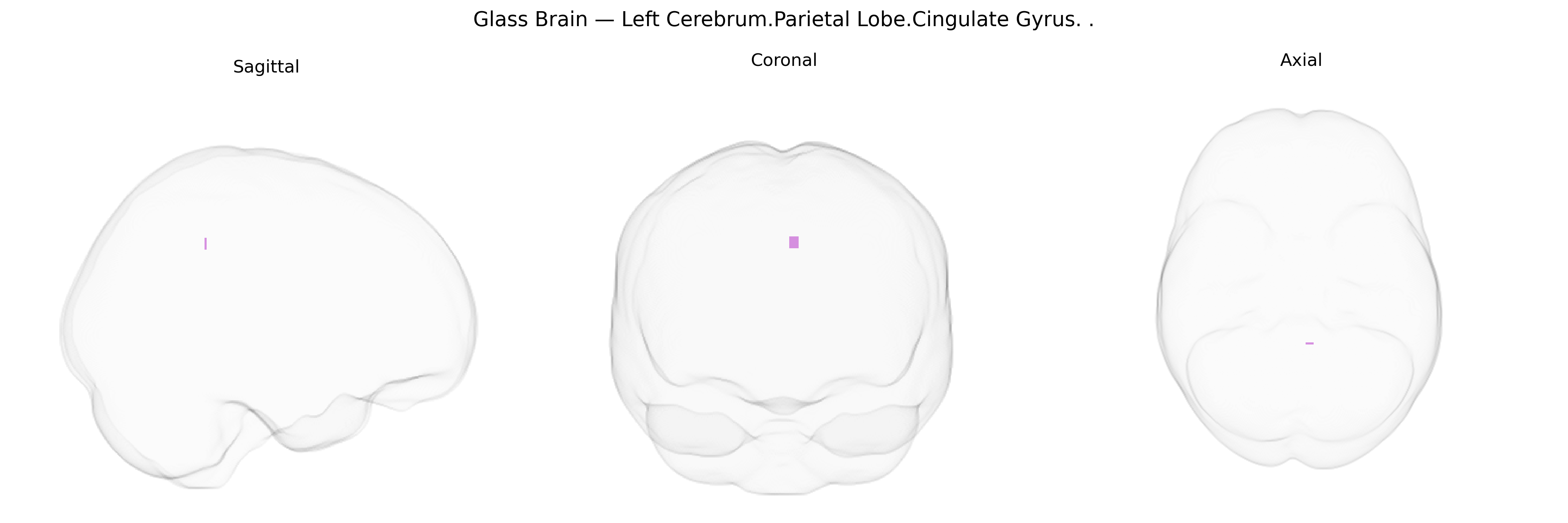 Triplanar Ghost Brain