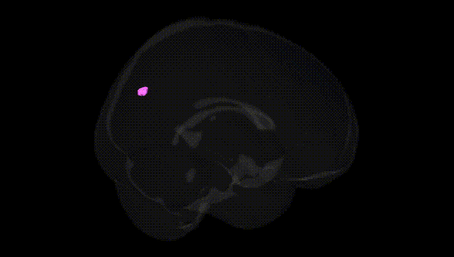Full Brain Black