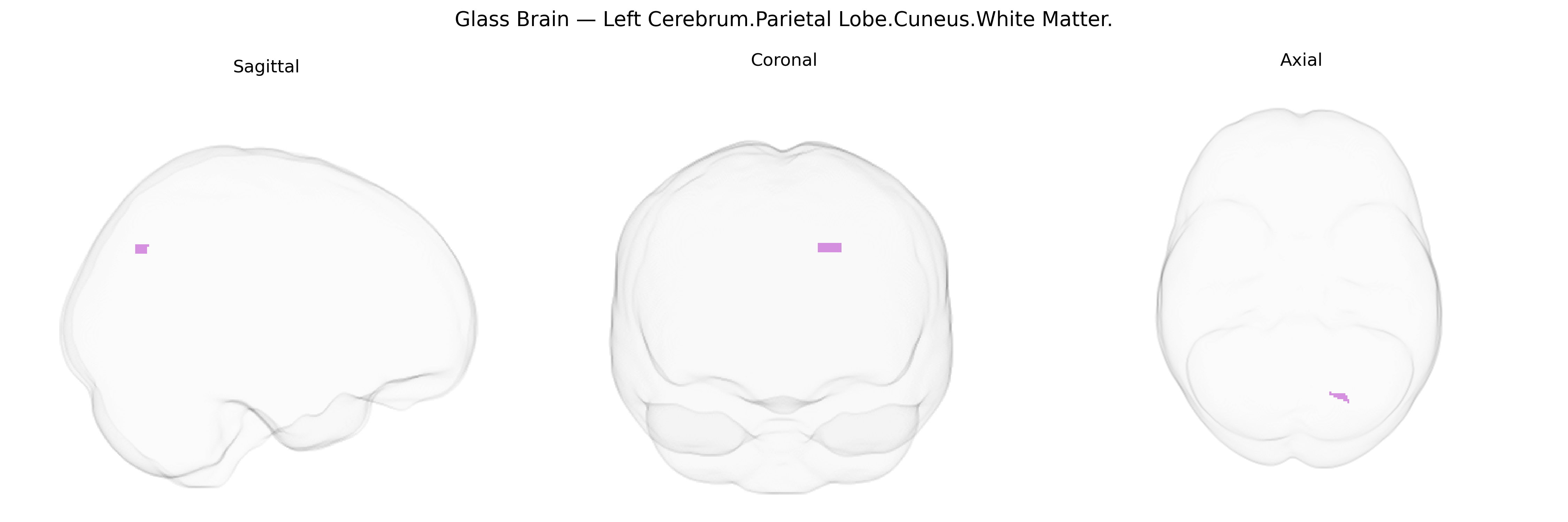 Triplanar Ghost Brain
