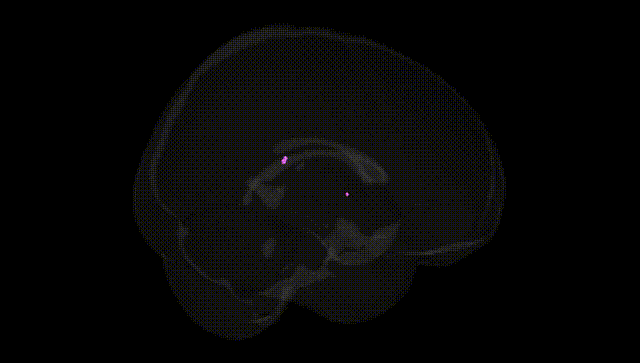 Full Brain Black