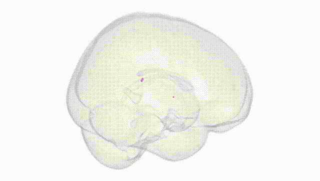 Full Brain White