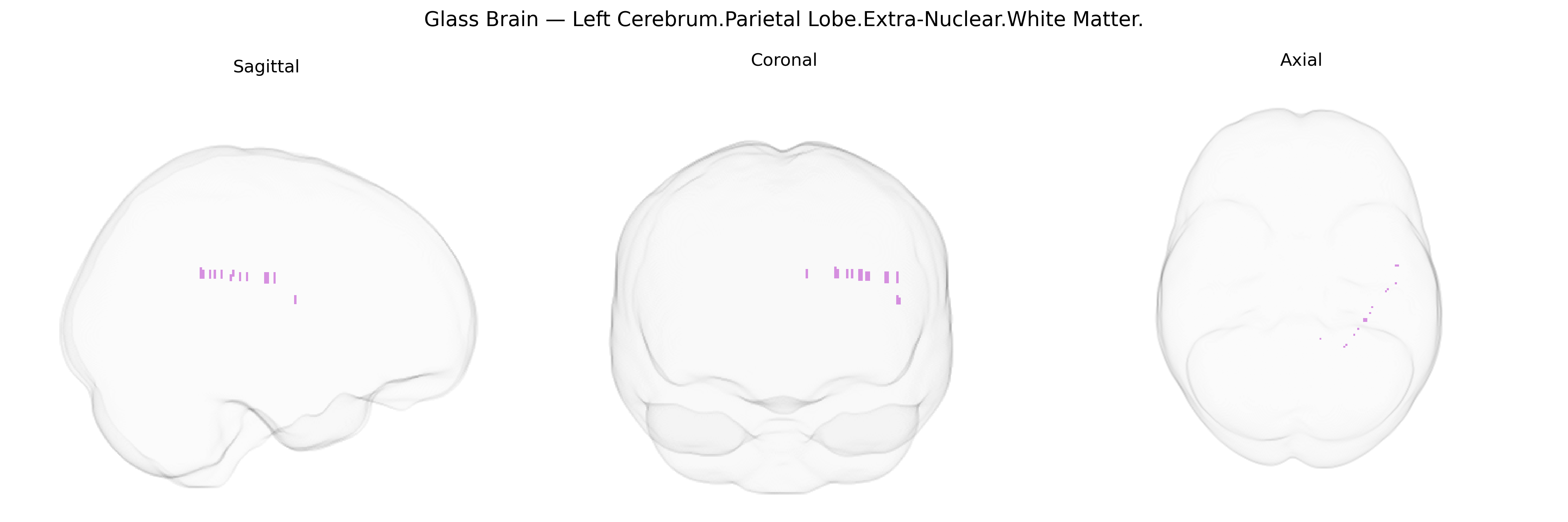 Triplanar Ghost Brain