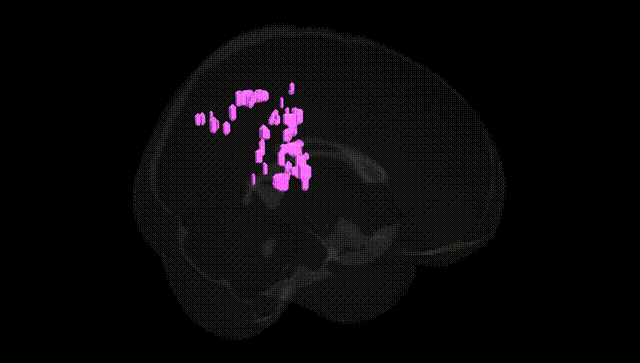 Full Brain Black