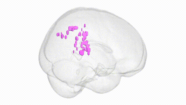 Full Brain White