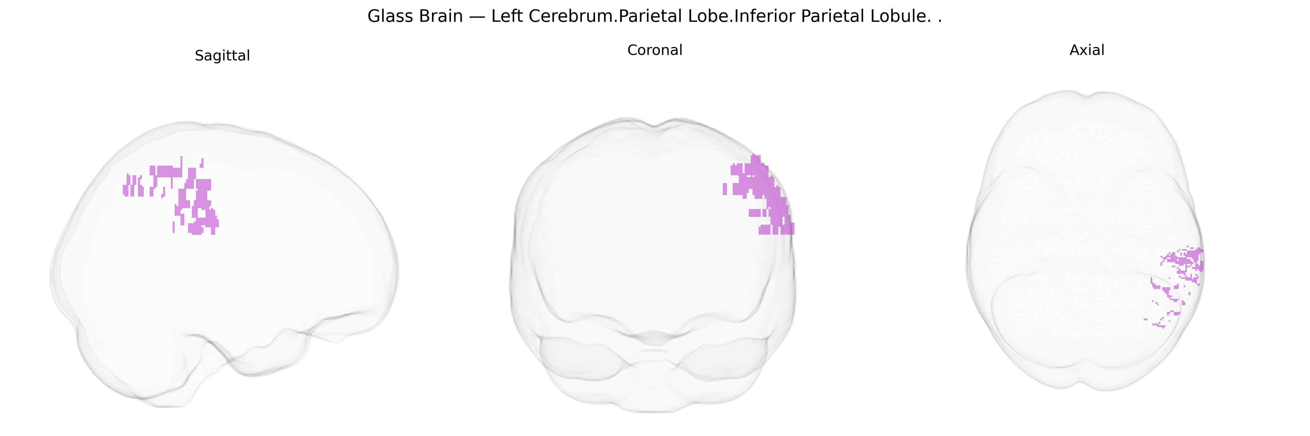 Triplanar Ghost Brain