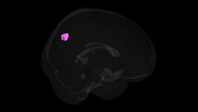 Full Brain Black