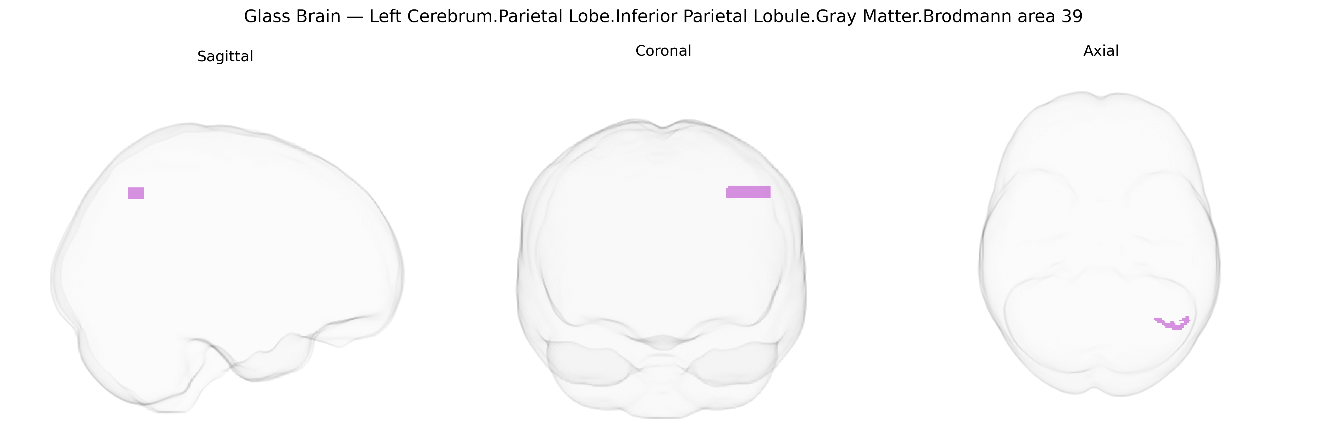 Triplanar Ghost Brain