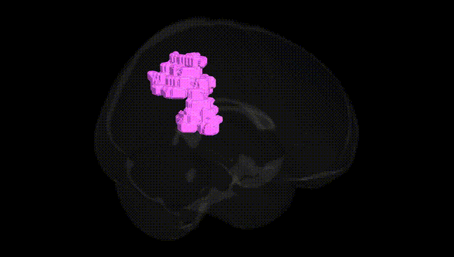 Full Brain Black