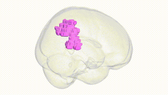 Full Brain White