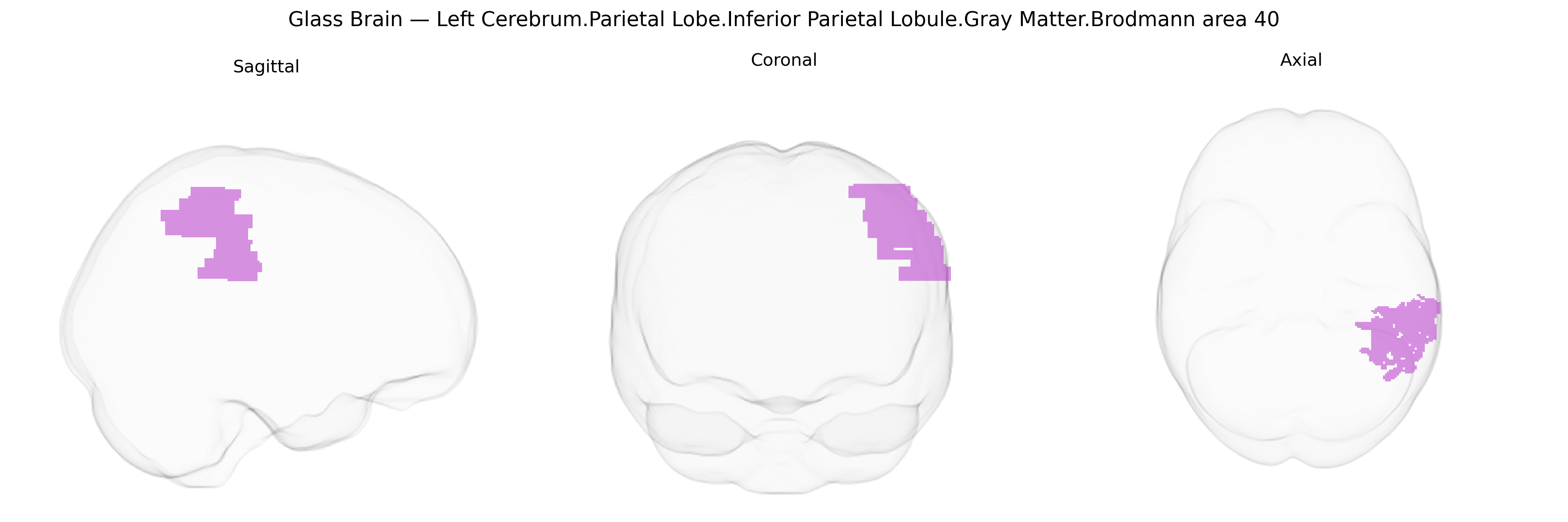 Triplanar Ghost Brain